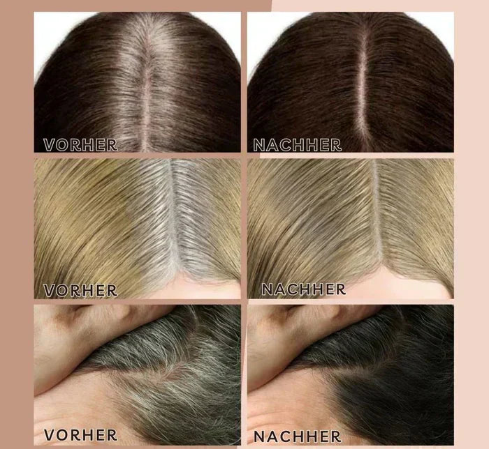 HairHalo – Always a perfect hairline