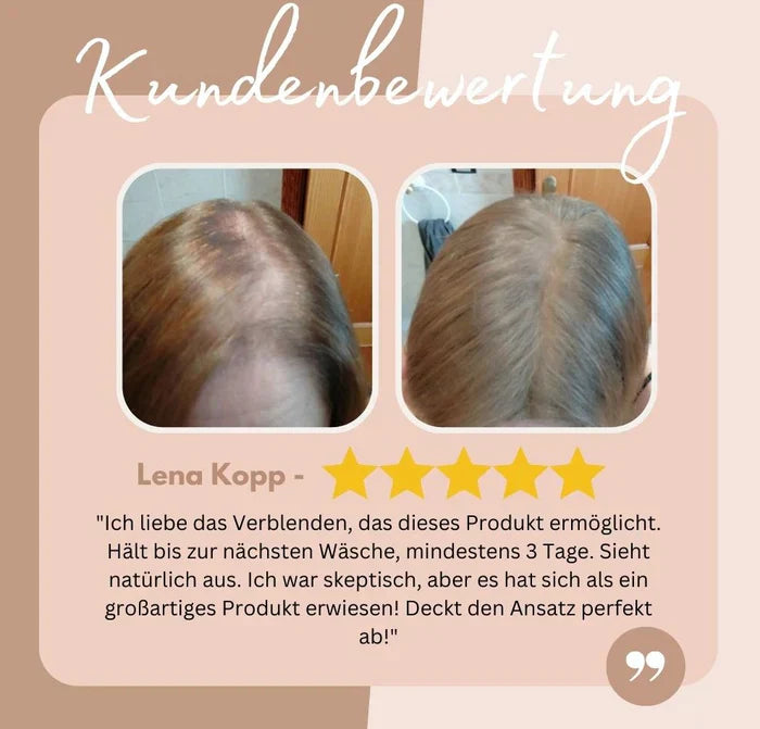 HairHalo – Always a perfect hairline