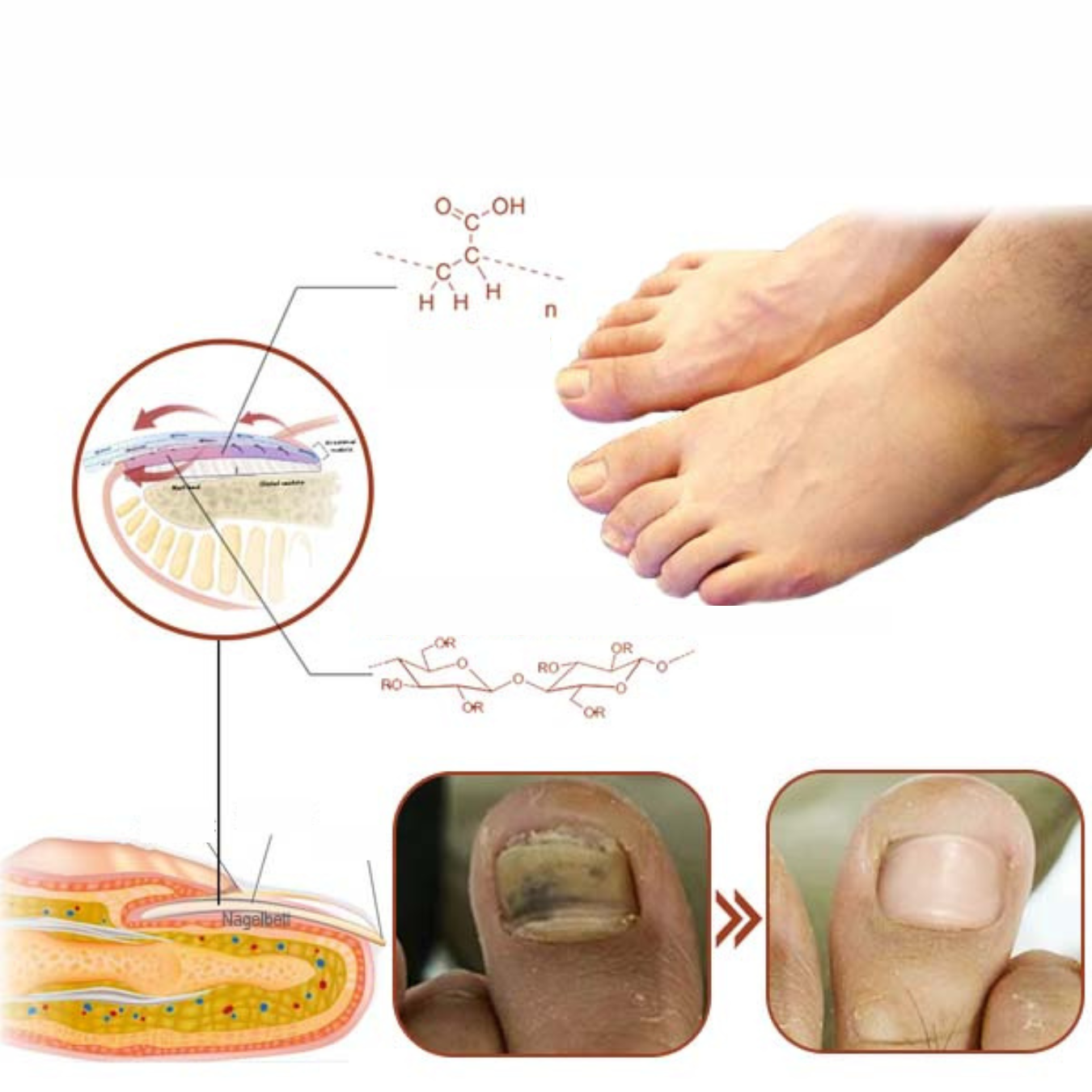 LumiNail - Visibly healthy nails without chemicals!