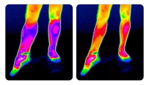 KneeTherm™ - Self-Heating Knee Support: Fast Pain Relief [Last Day Sale] 