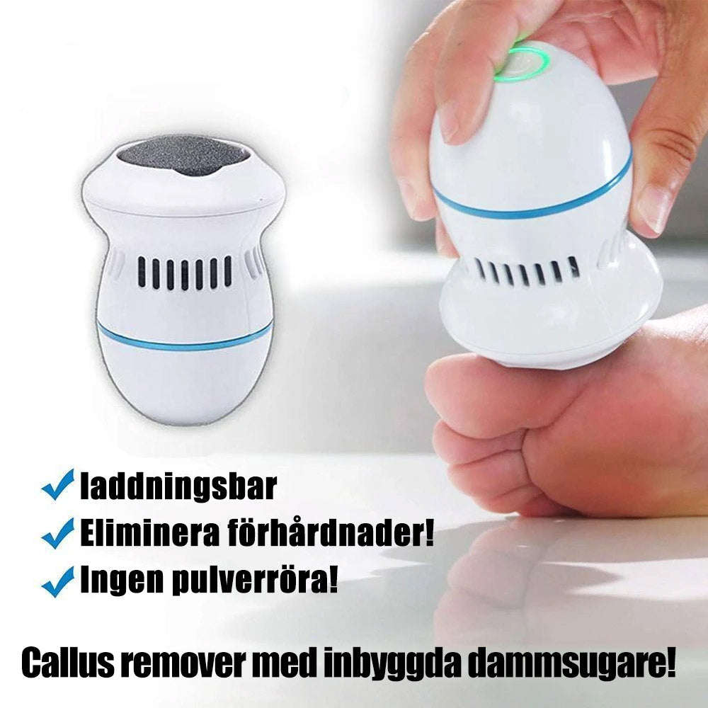 SoleSmooth - callus remover