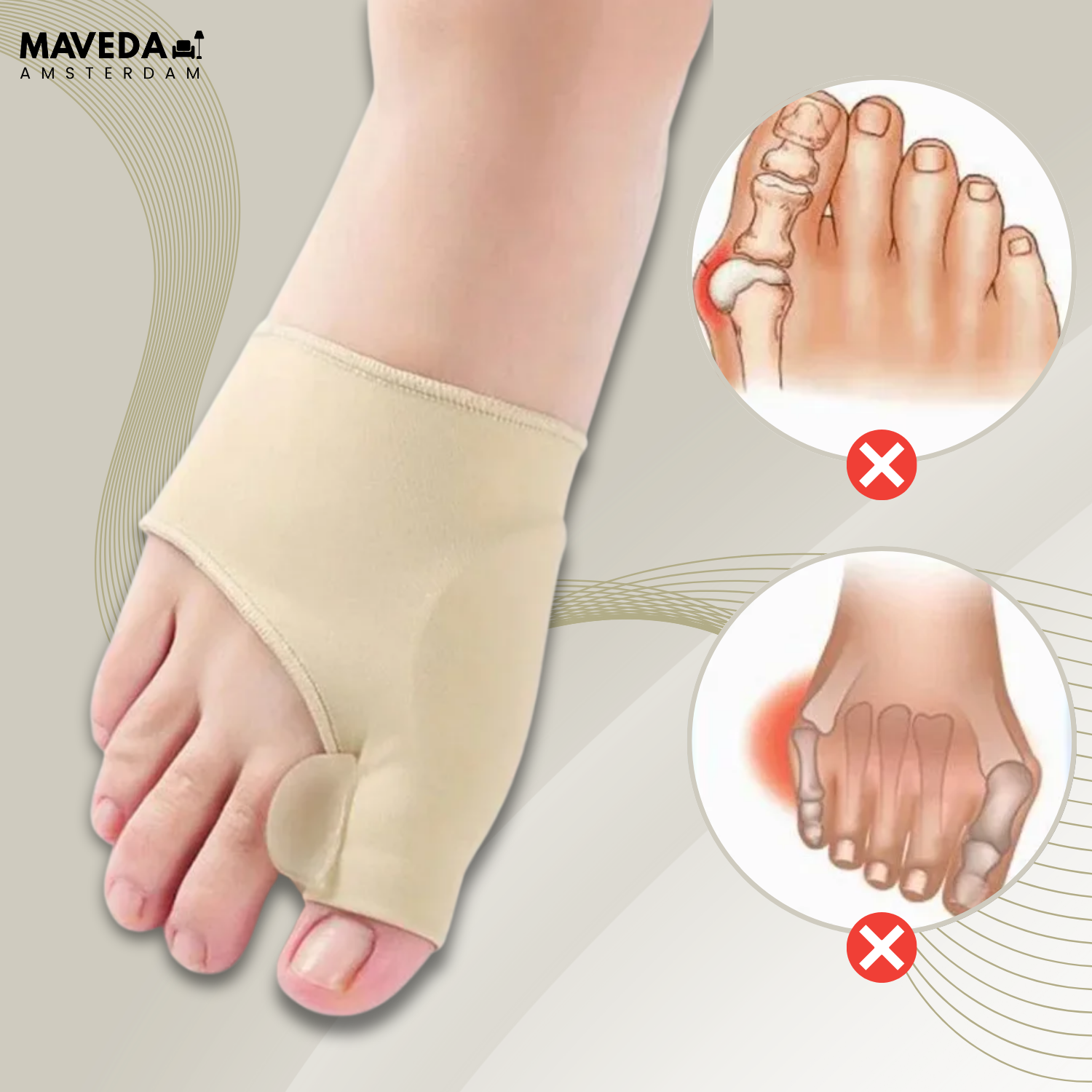 OrthoToe™ - Instant pain relief for hallux valgus