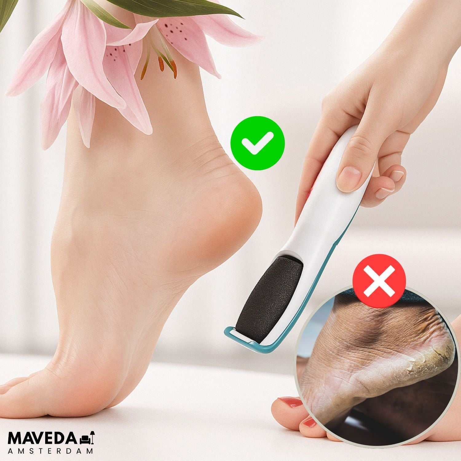 SilkaFeet™ - Effortlessly smooth and cared for feet