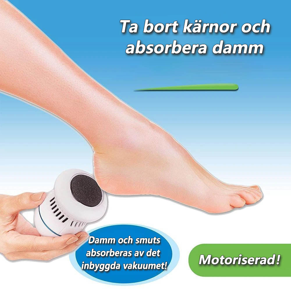 SoleSmooth - callus remover