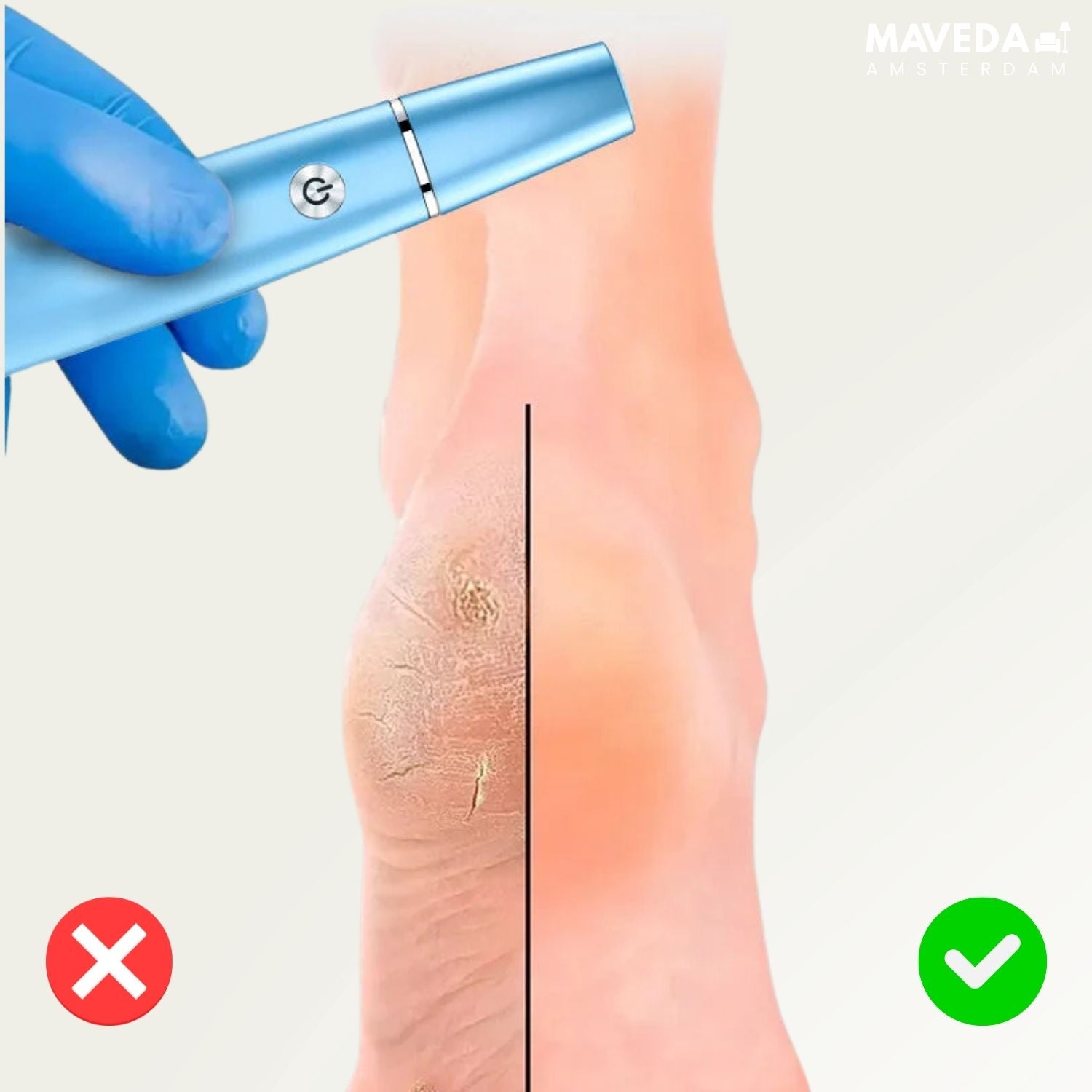 SilkaFeet™ - Effortlessly smooth and cared for feet
