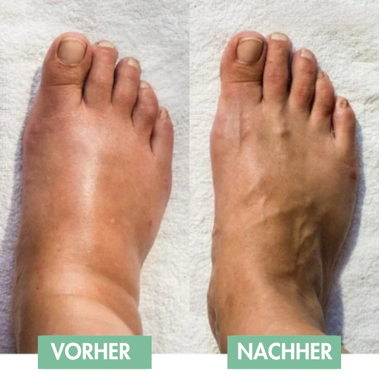 RelaxaPad - The easy way to relieve foot pain