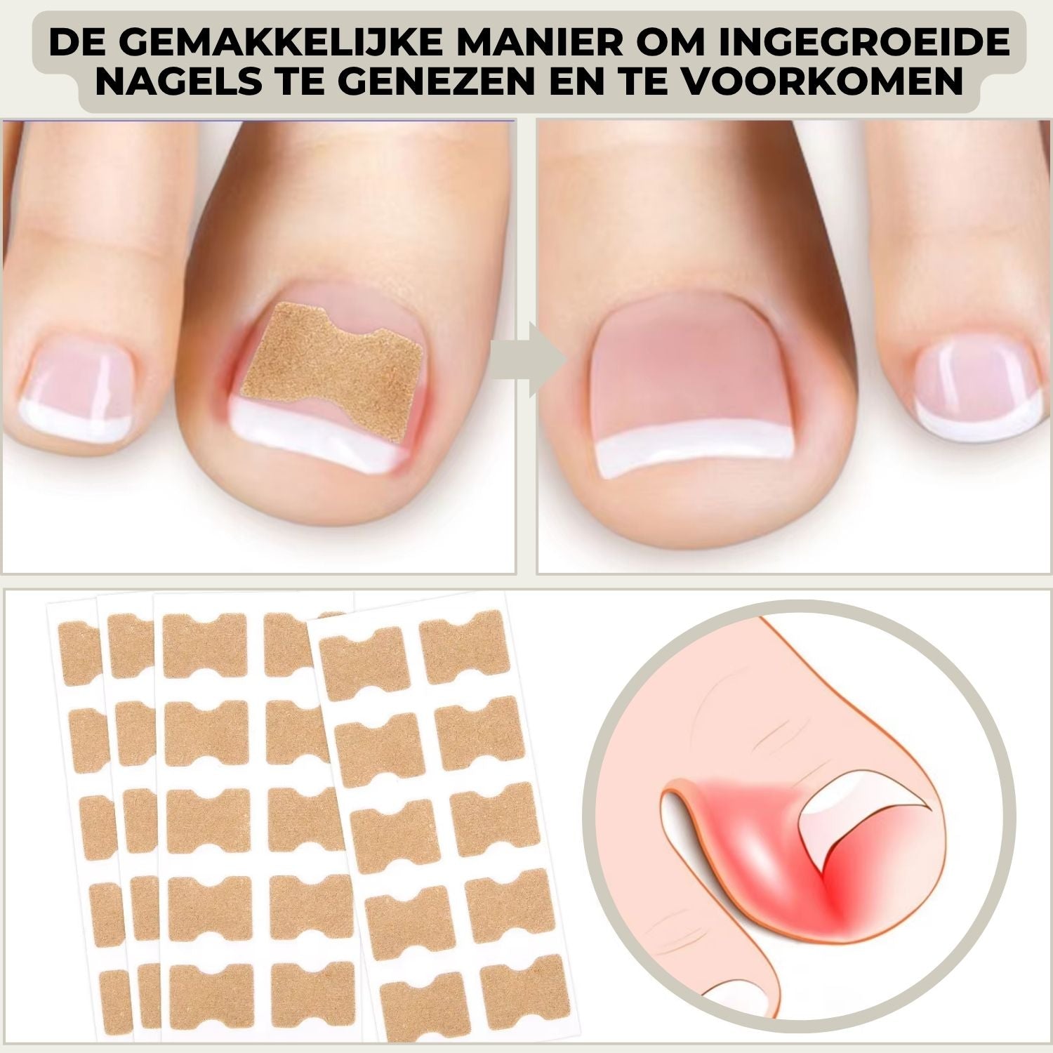 10+10 FREE | FixaNail™ - Instant nail repair