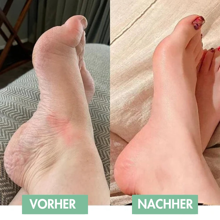 RelaxaPad - The easy way to relieve foot pain