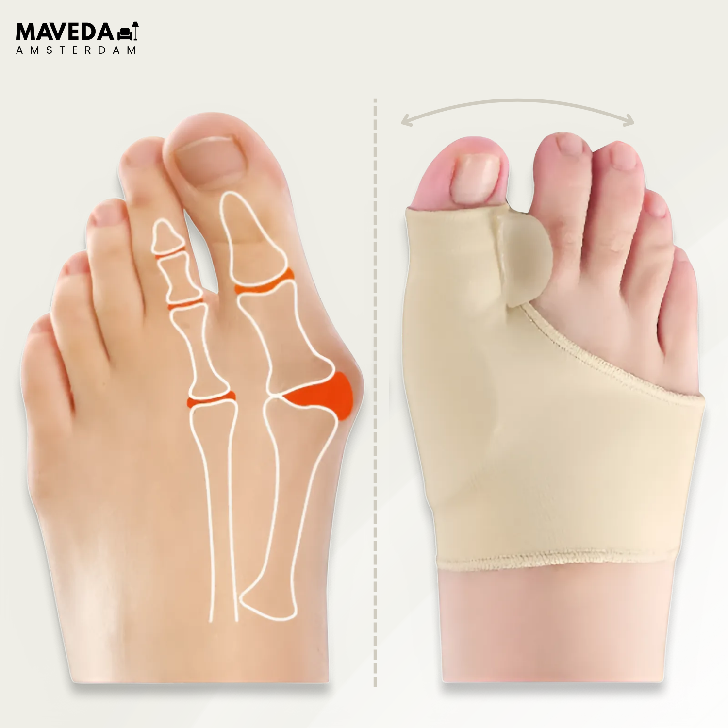 OrthoToe™ - Instant pain relief for hallux valgus