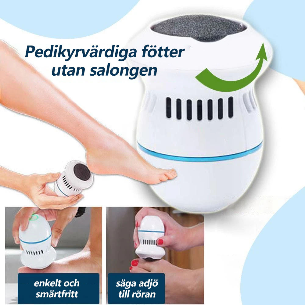 SoleSmooth - callus remover