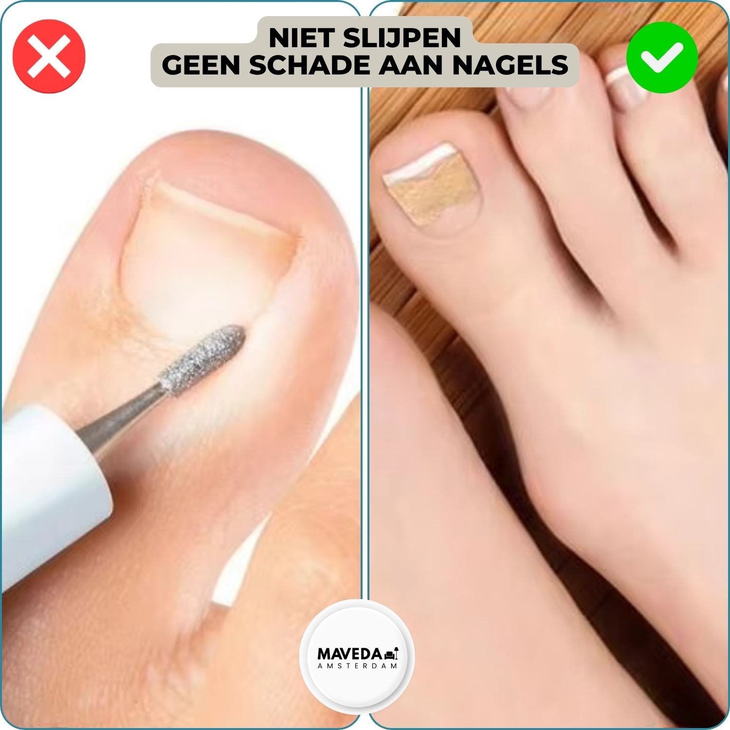 10+10 FREE | FixaNail™ - Instant nail repair