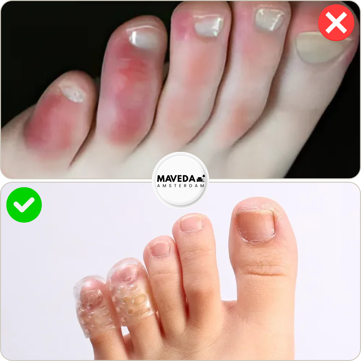 5+5 FREE | SafeWalk™ - Never suffer from sore feet again! [Last day of sale]