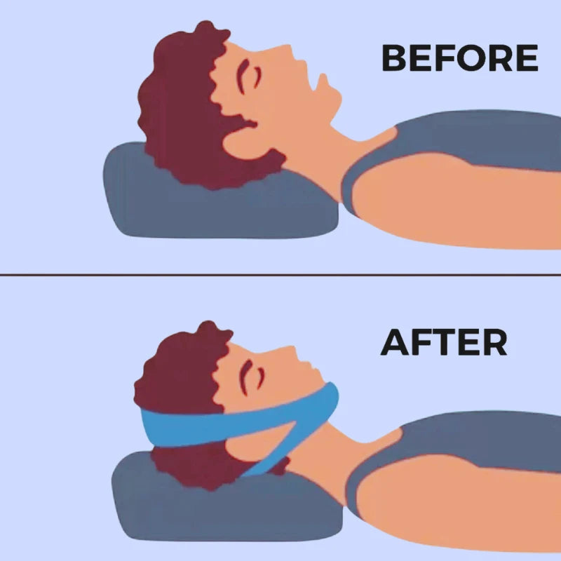 SilentFit - The comfortable chin strap for peaceful nights
