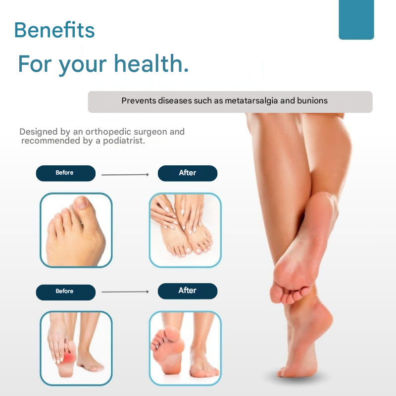 Buy 1+1 FREE | FlexiToes™ – pain relief and posture correction for your feet