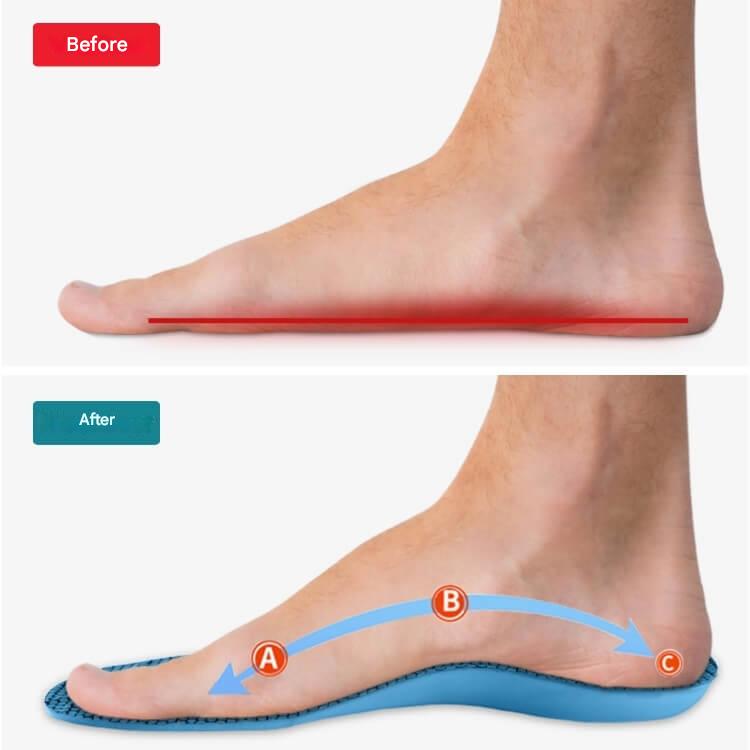 SoleCure – Pain-free steps from day one