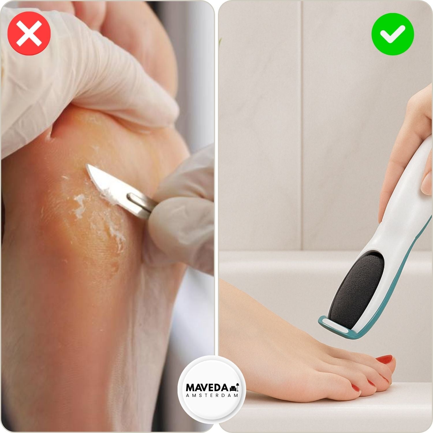 SilkaFeet™ - Effortlessly smooth and cared for feet