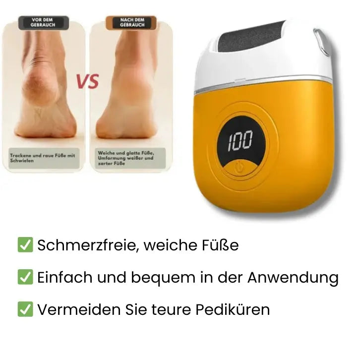 SmoothSole - pain-free feet in just a few minutes 