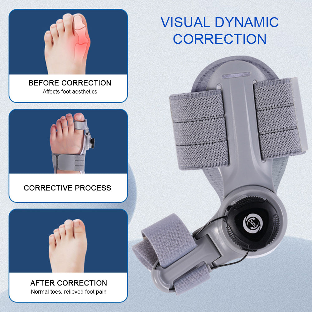 AlignEase - Pain-free walking without surgery