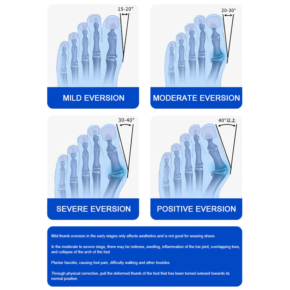 AlignEase - Pain-free walking without surgery