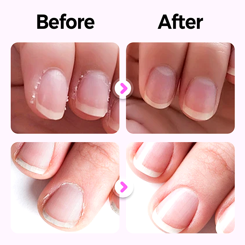 3-in-1 Nagelverzorgingsstick voor Gladde, Gezonde Nagels