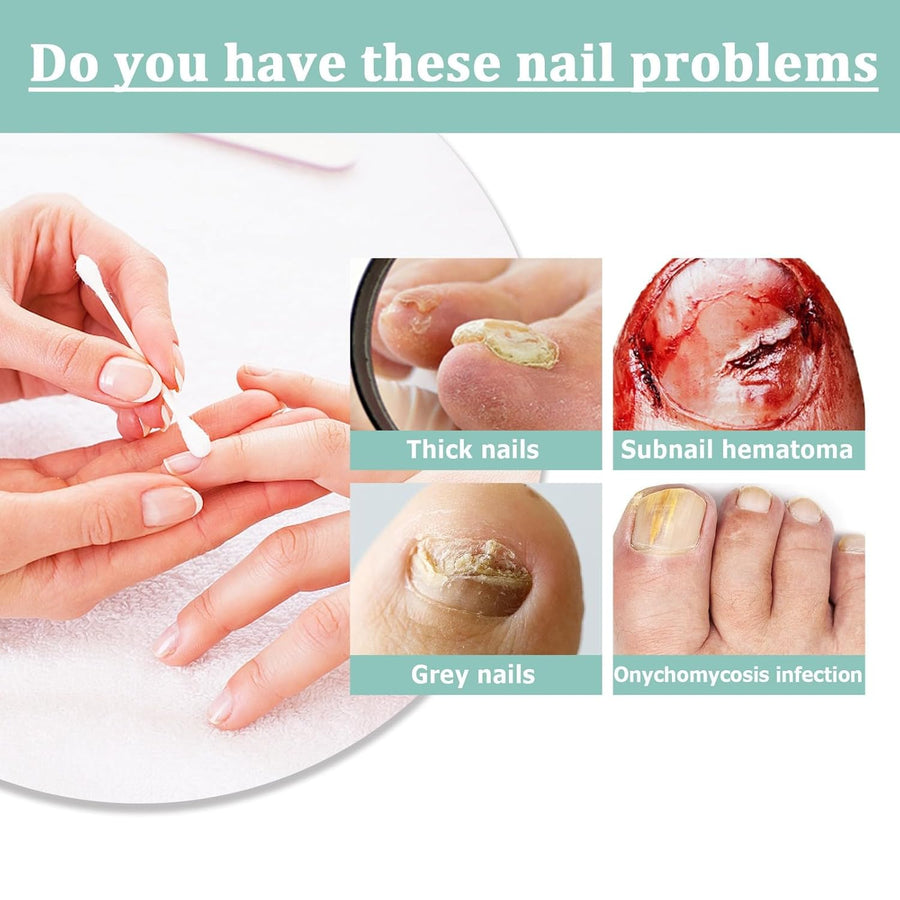 Buy 1+1 FREE | NailBloom - Say goodbye to brittle nails forever