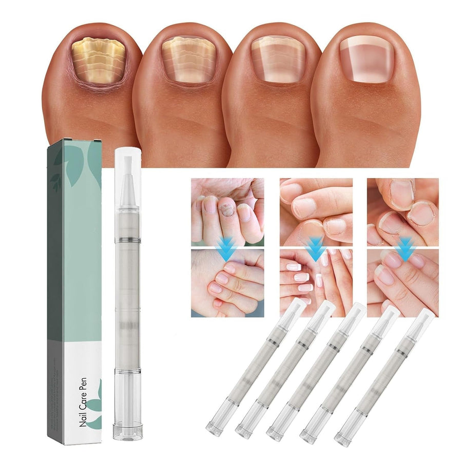 Buy 1+1 FREE | NailBloom - Say goodbye to brittle nails forever