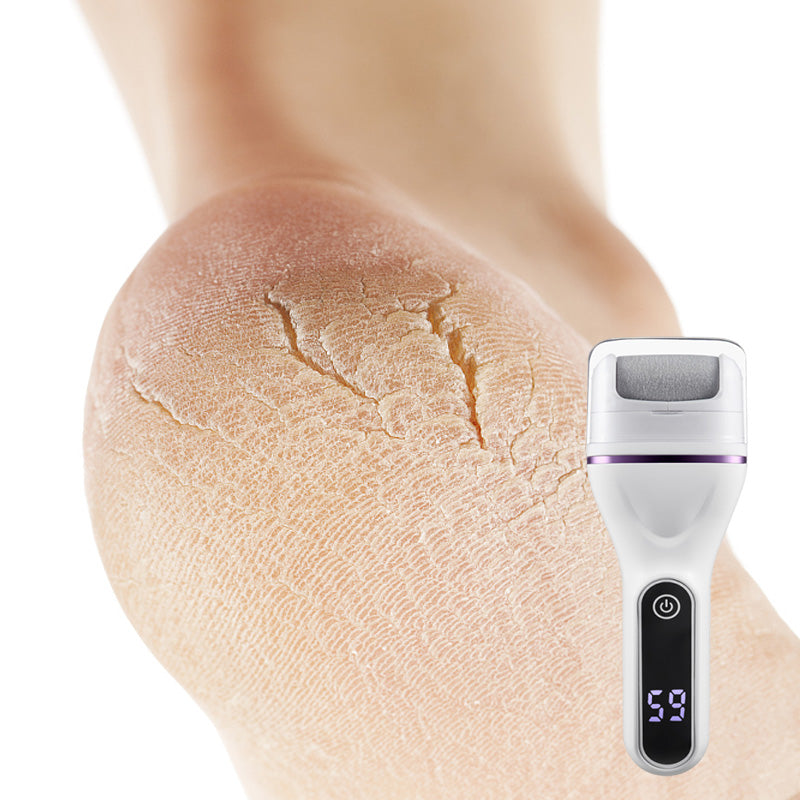 SoftStep Pro - For velvety soft feet in minutes